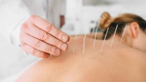 benefits of acupressure and acupuncture