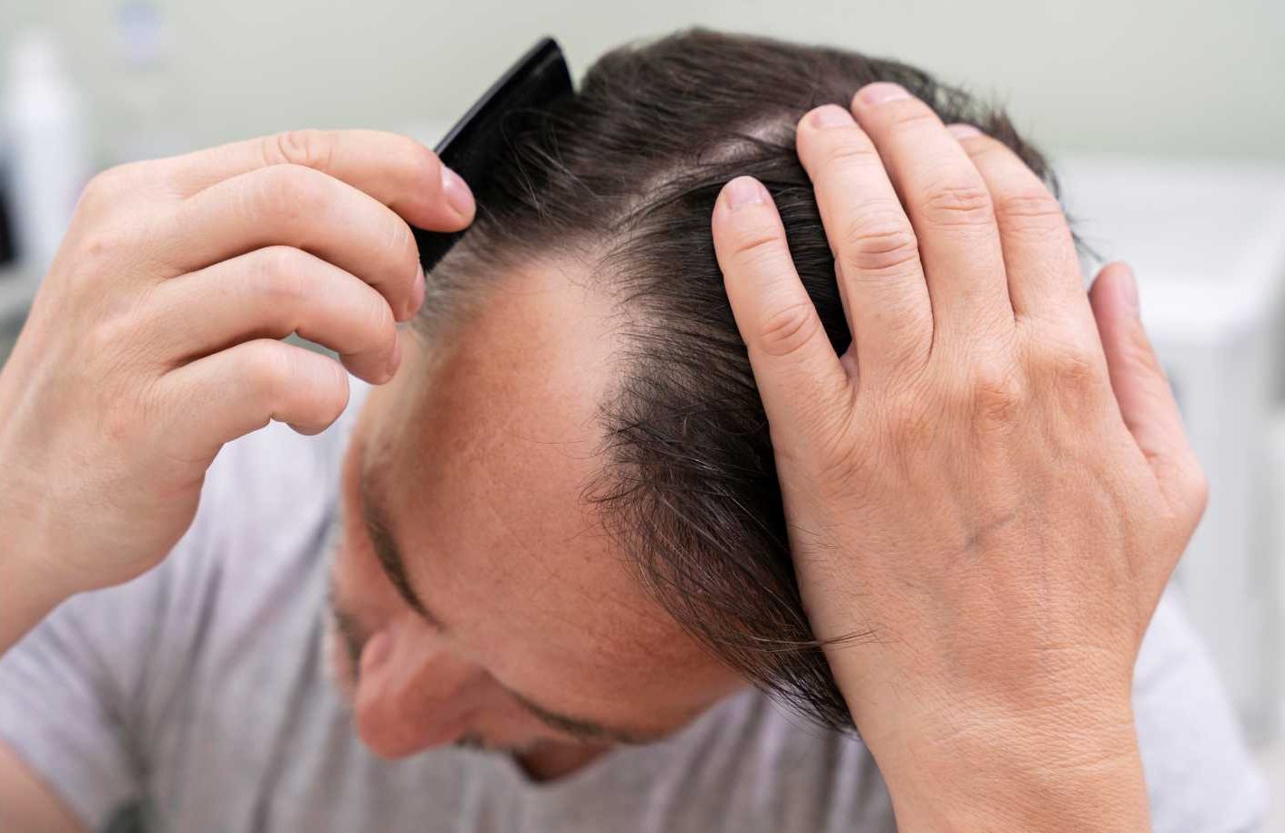 hair loss or thinning hair