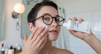 The Ultimate Skincare Routine for Acne-Prone Skin